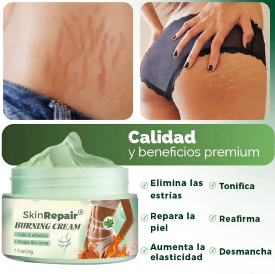 Crema antiestrias Skinrepair